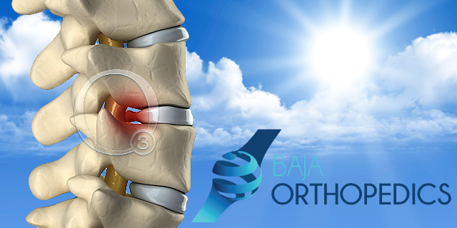 Ortopedics Tijuana, Ozone Therapy